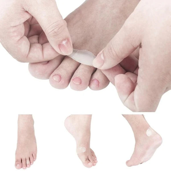 BlisterPod Hydrocolloid Blister Patches